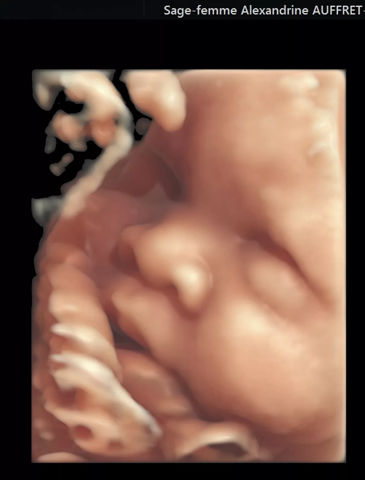 CEMSF LES SABINES - Echo face 3D