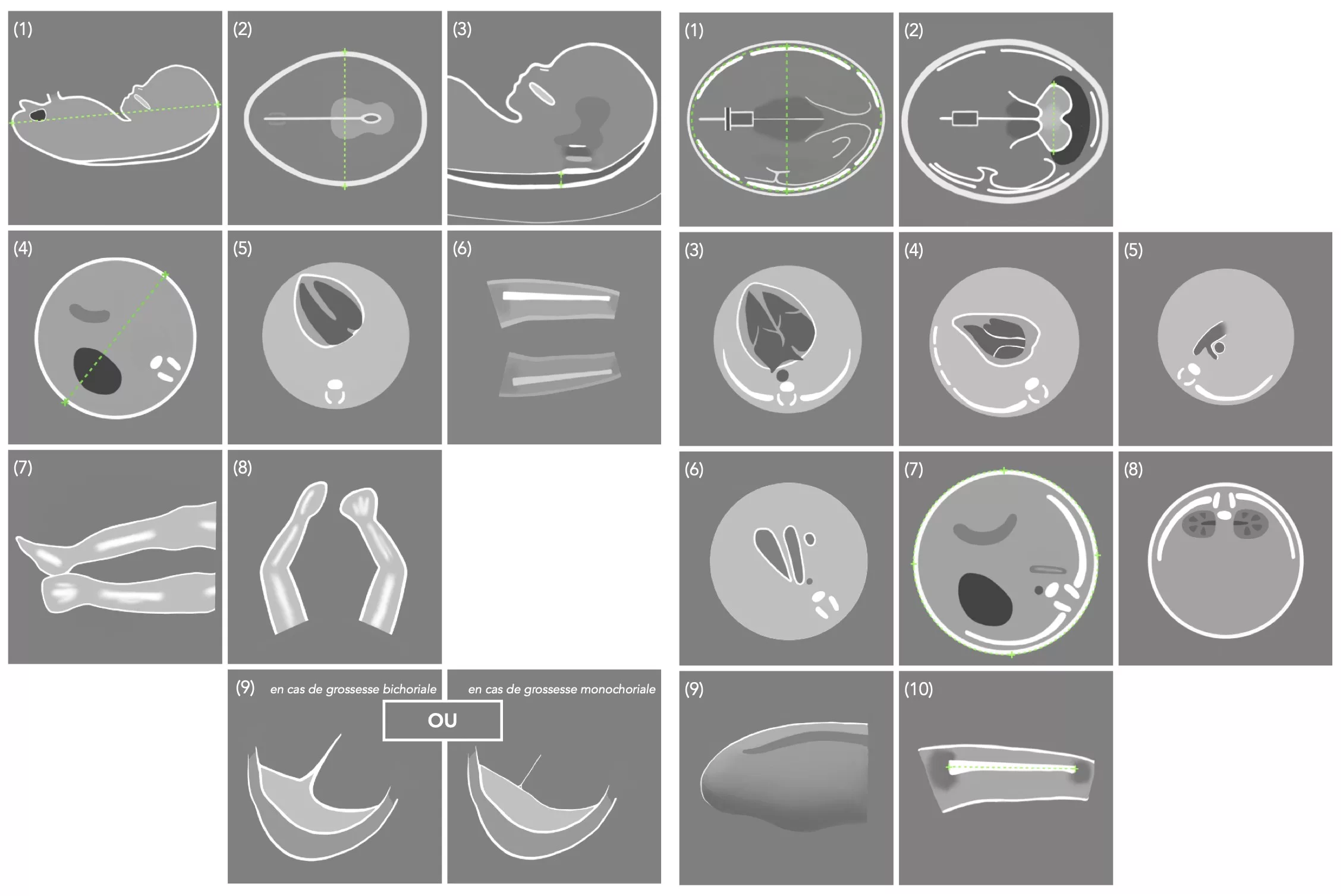 CEMSF Les Sabines - CNEOF T1 T3